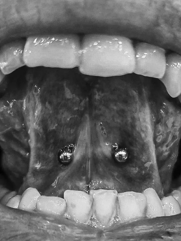 Zungenbändchen Piercing