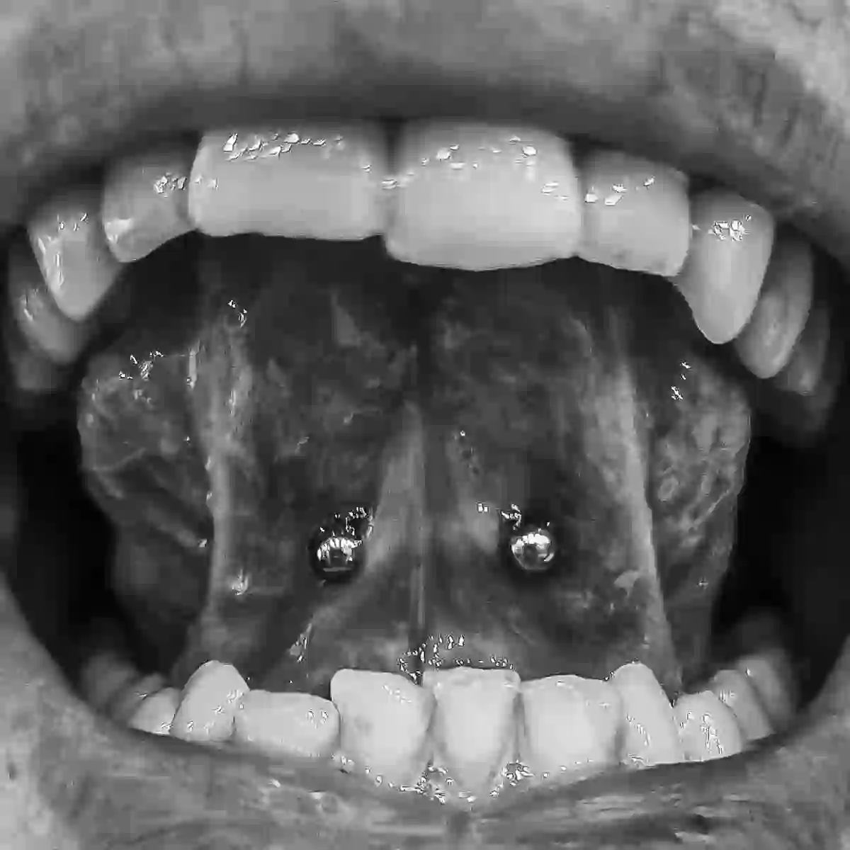 Zungenbändchen Piercing